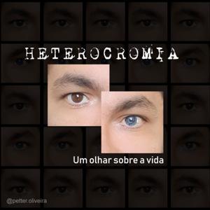 Heterocromia | Um Olhar Sobre a Vida