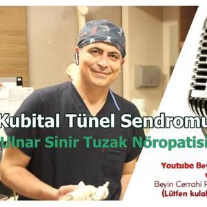 Kubital Tünel Sendromu (Ulnar sinir tuzak nöropatisi) Prof. Dr. Duran Berker Cemil