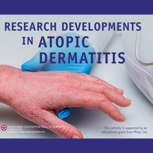 Research Developments in Atopic Dermatitis