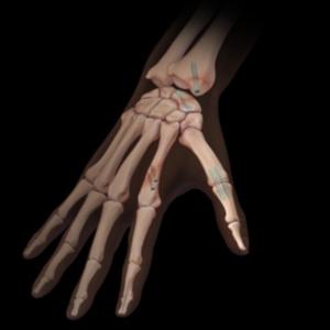 Muñeca y mano TMG