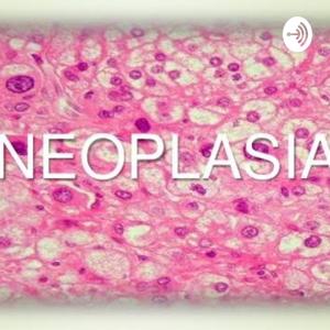 Neoplasias