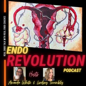 Endo Revolution Podcast