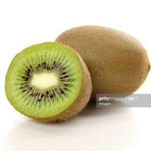 Free Kiwis! by James