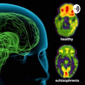 LivingAndThrivingWithSchizophrenia by Isaac Garcia