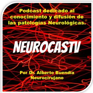 Neurocastv