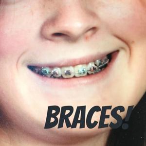 Braces!