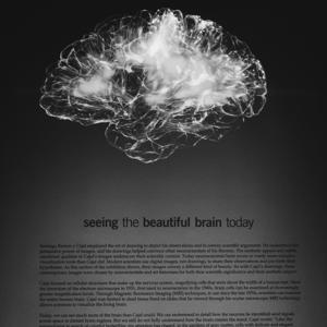 My Beautiful Mind