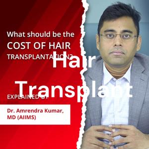 Hair Transplant