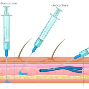 Los 4 Tipos de Inyecciones