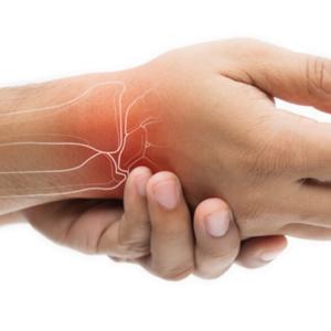 Rheumatoid Arthritis Disease