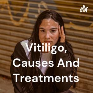 Vitiligo, Causes And Treatments by Alex