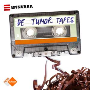 De Tumor Tapes