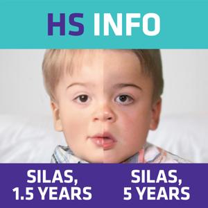 Hunter syndrome Info