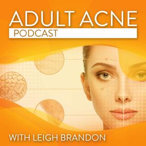 Adult Acne Podcast