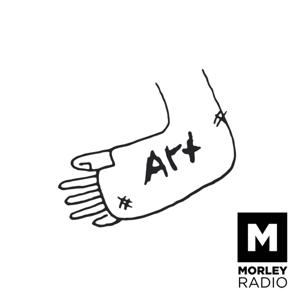 Art Cast