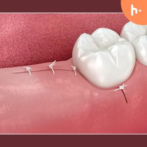 Dental Treatment