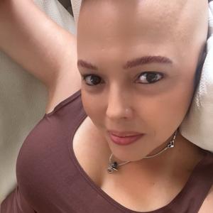 Alopecia Universal -  Mi proceso