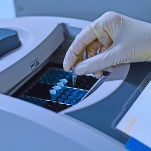 How to Optimize Your PCR Workflow with 96-Well PCR Plates