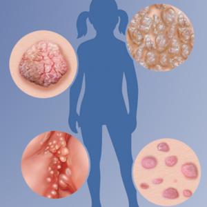 Pediatric Skin-Sights