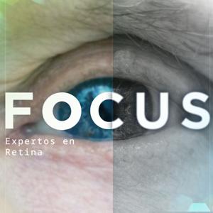Focus, expertos en retina, by Bayer