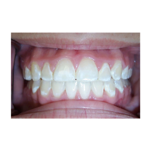 Smile Stories: Transforming Lives Through Dentistry