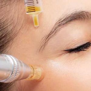 PRP With Microneedling Dallas Texas