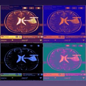 Tumor Talk