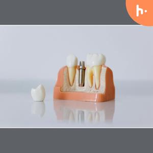 Smile Bright Again with Dental Implants in Washington