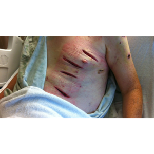 CIA and GLOMAR status here