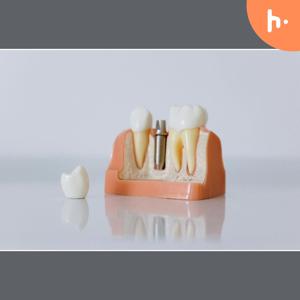 Exceptional Benefits of an Implant Dentist in Los Gatos