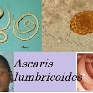 ASCARIS LUMBRICOIDES