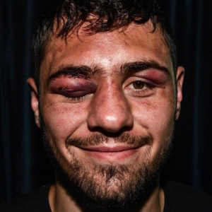 Dave Allen's boxing talk