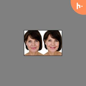 Unveiling a Youthful Glow: Chemical Peel Treatment at Lifestyle's MedSpa