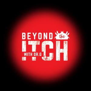Beyond The Itch