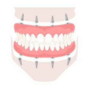 Smile Anatomy