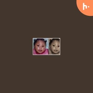 Advocacy for special needs kids