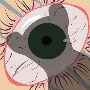 Rabid Weasel Podcast