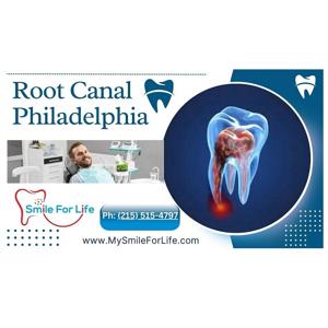 Root Canal Philadelphia