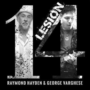 Lesion14 ft George Varghese