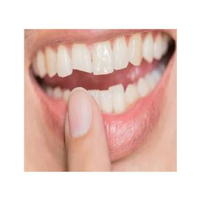 Cosmetic Dentist St Louis