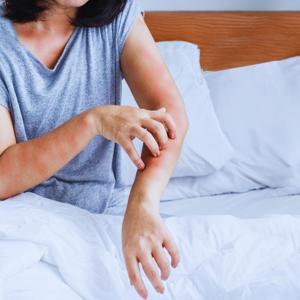 Handling Allergic Reactions to Essential