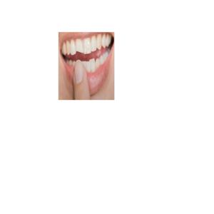 best cosmetic dentist St Louis