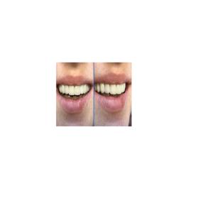 Best Dentist Northeast Philadelphia