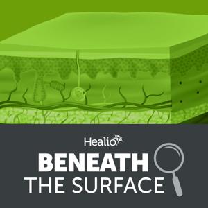 Beneath the Surface