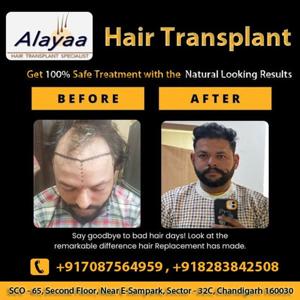 Hair Transplantation and Restoration Hai
