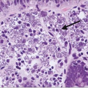 G5 y Leishmania