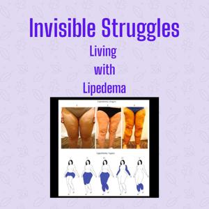 Invisible Struggles: Living with Lipedema by BC