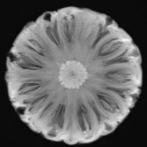 Resonancia Magnética