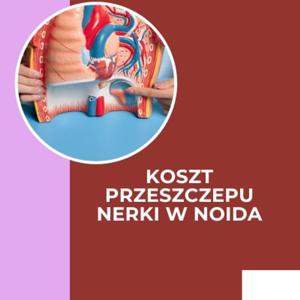 Jaki jest koszt przeszczepu nerki w Noid