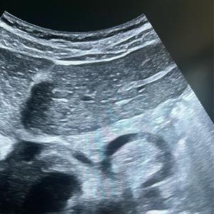 Playbook Ultrasound